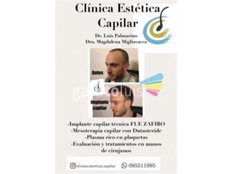 https://www.gallito.com.uy/clinica-estetica-capilar-para-famosos-argentina-servicios-22837450